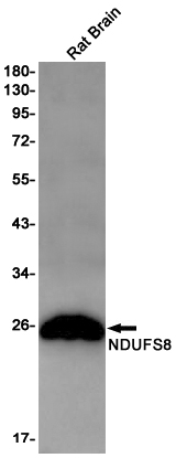 NDUFS8 Rabbit mAb ABZ3074