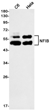 NFIB Rabbit mAb ABZ3079