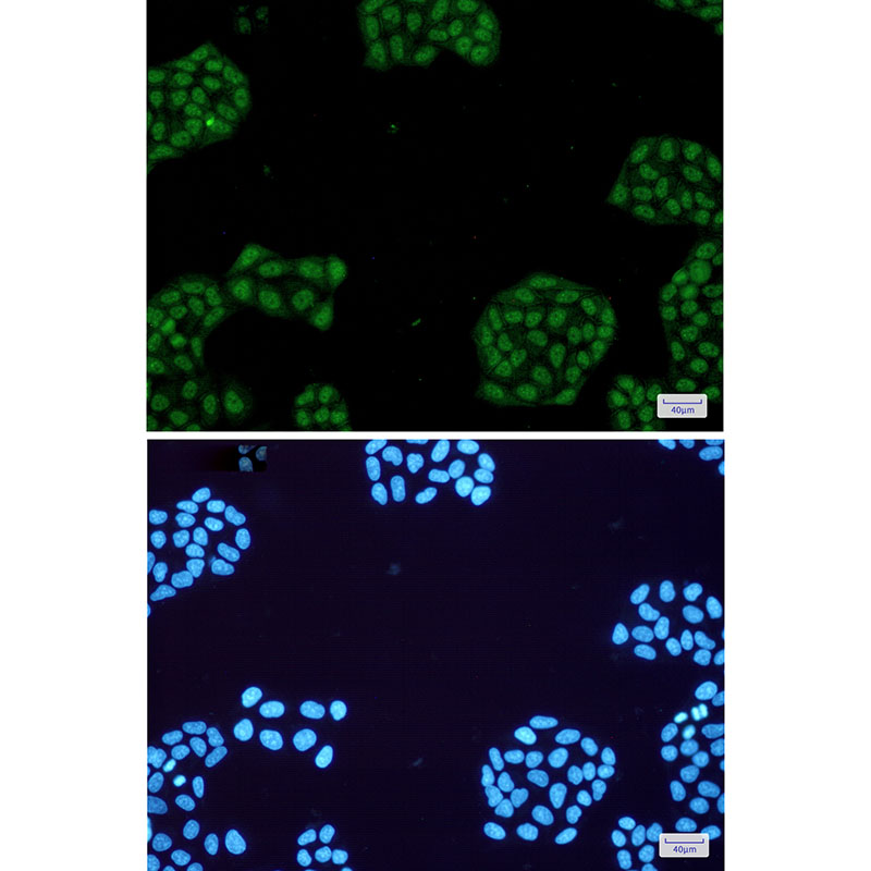 NR1D1 Rabbit mAb ABZ3082