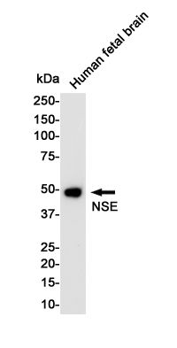 NSE Rabbit mAb ABZ3084