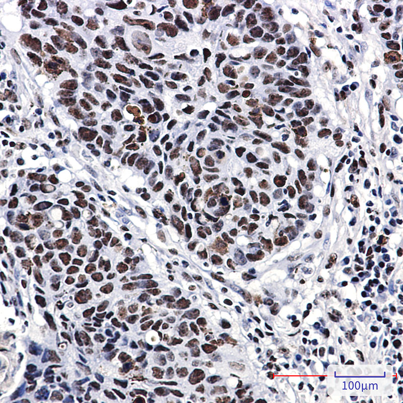 Nucleophosmin Rabbit mAb ABZ3085