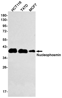 Nucleophosmin Rabbit mAb ABZ3085