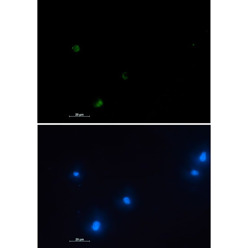 NUDT19 Rabbit mAb ABZ3087