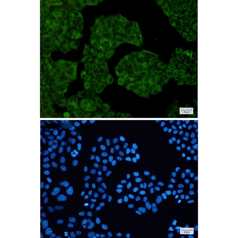 NUDT9 Rabbit mAb ABZ3088