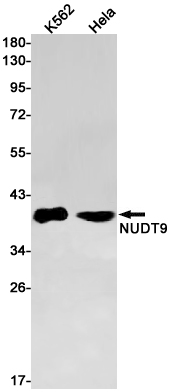 NUDT9 Rabbit mAb ABZ3088