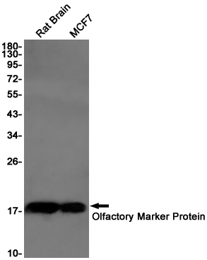 Olfactory Marker Protein Rabbit mAb ABZ3094