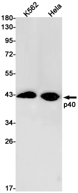 p40 Rabbit mAb ABZ3096