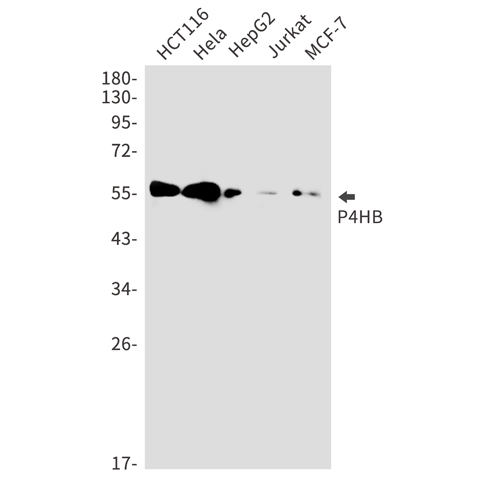 P4HB Rabbit mAb ABZ3097
