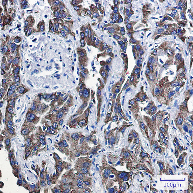 P4HB Rabbit mAb ABZ3098