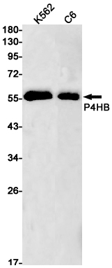P4HB Rabbit mAb ABZ3098