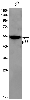 p53 Rabbit mAb ABZ3099