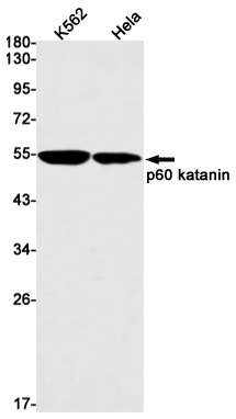 p60 Katanin Rabbit mAb ABZ3100