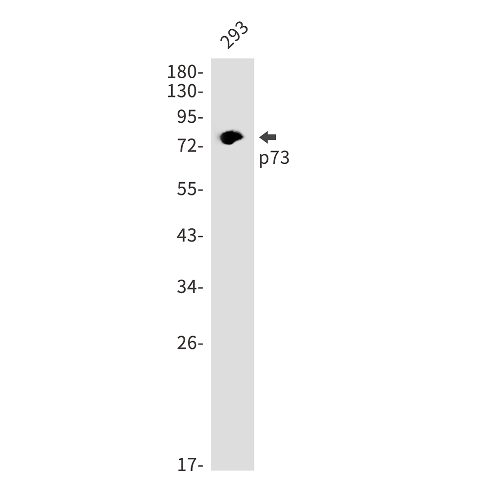 p73 Rabbit mAb ABZ3101