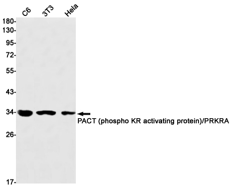 PRKRA Rabbit mAb ABZ3103