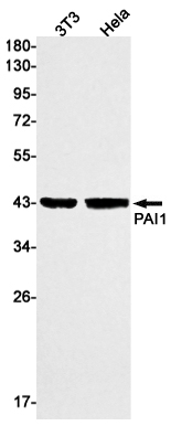 PAI1 Rabbit mAb ABZ3104