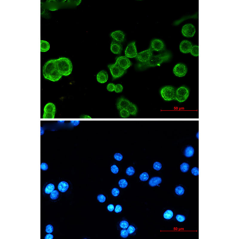 P cadherin Rabbit mAb ABZ3106