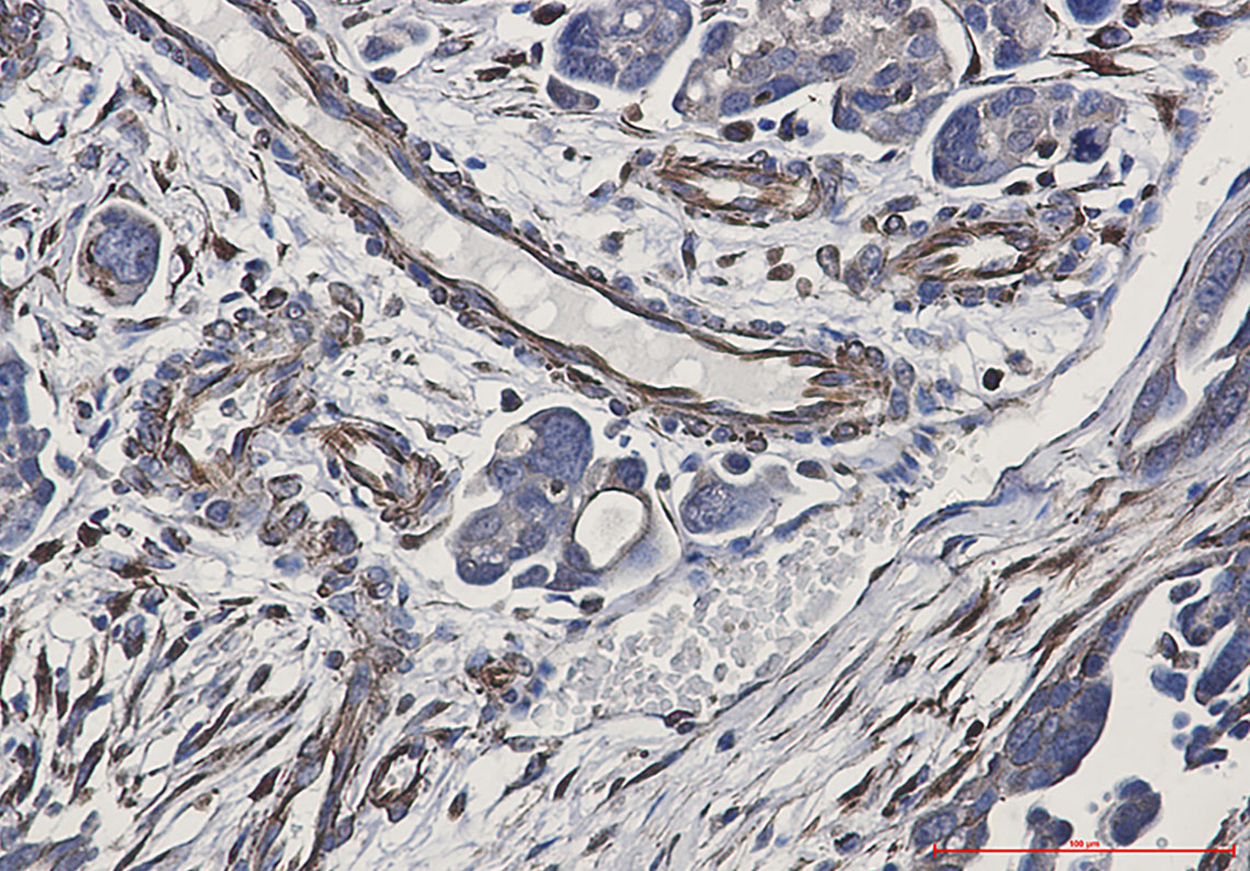 P cadherin Rabbit mAb ABZ3106