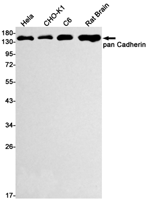 P cadherin Rabbit mAb ABZ3106