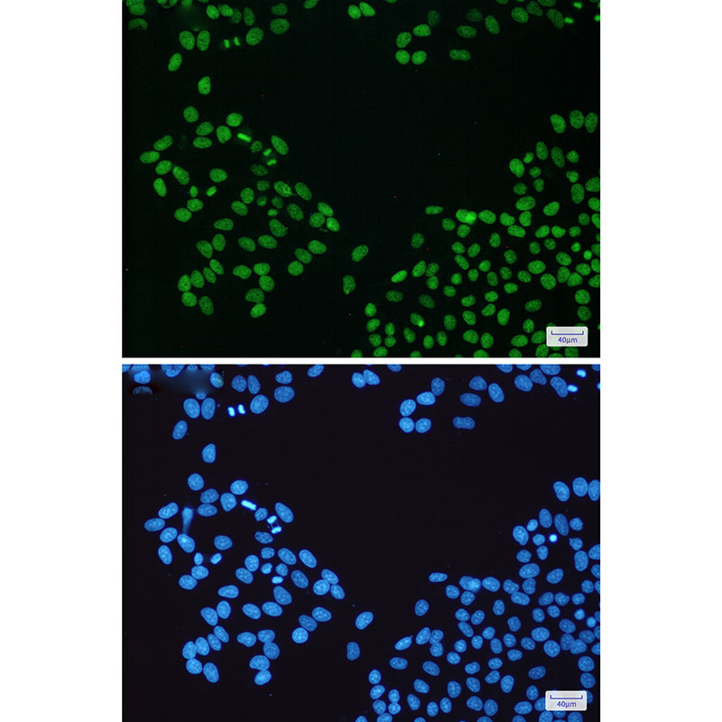 PARP1 Rabbit mAb ABZ3107