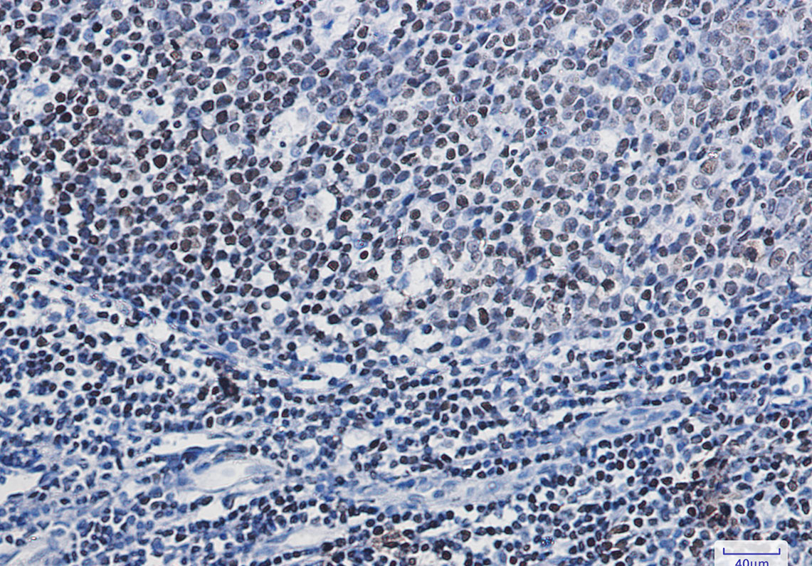 PARP1 Rabbit mAb ABZ3107