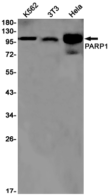 PARP1 Rabbit mAb ABZ3107