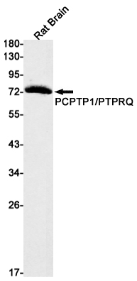 PCPTP1 Rabbit mAb ABZ3108