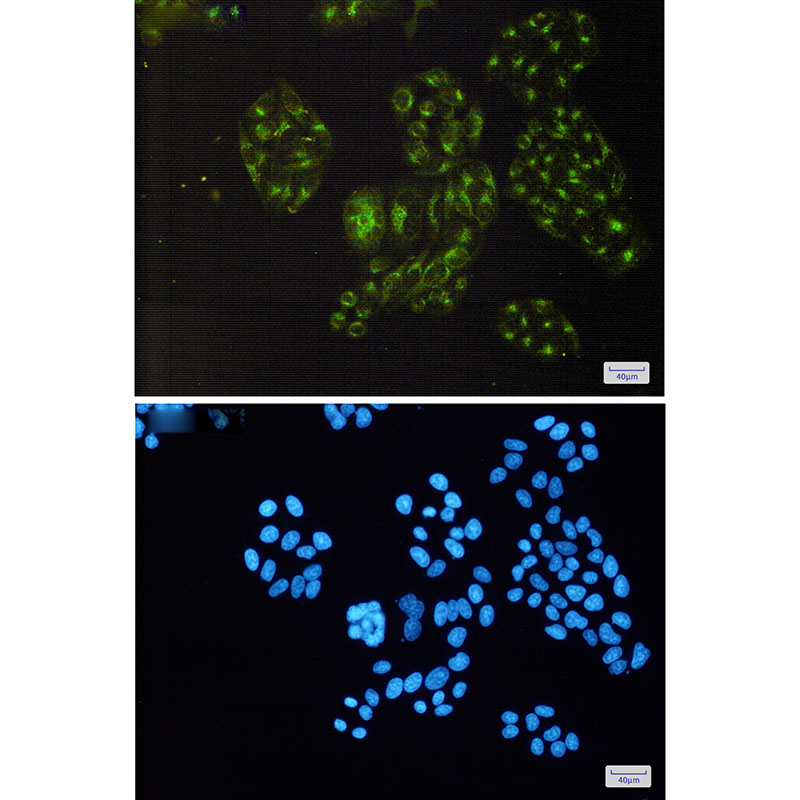 PDLIM1/CLP36 Rabbit mAb ABZ3112