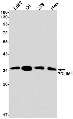 PDLIM1/CLP36 Rabbit mAb ABZ3112