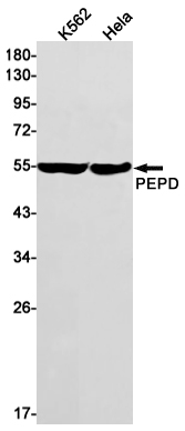 PEPD Rabbit mAb ABZ3114
