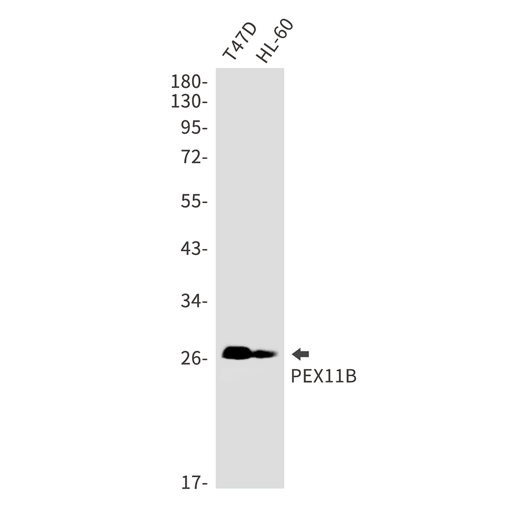 PEX11B Rabbit mAb ABZ3115