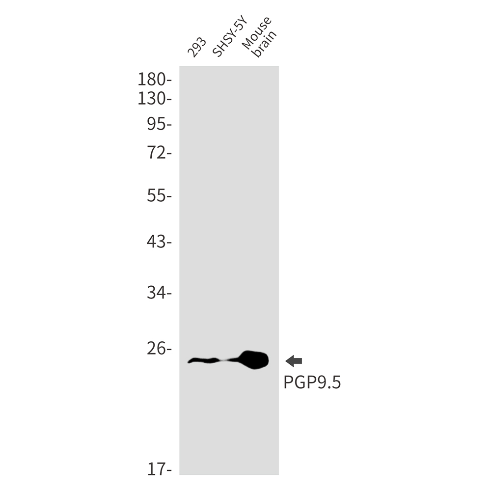 UCH-L1/PGP9.5 Rabbit mAb ABZ3116