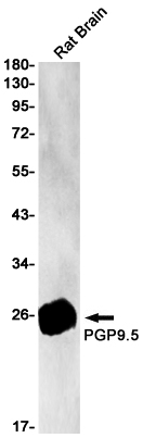 UCH-L1/PGP9.5 Rabbit mAb ABZ3116