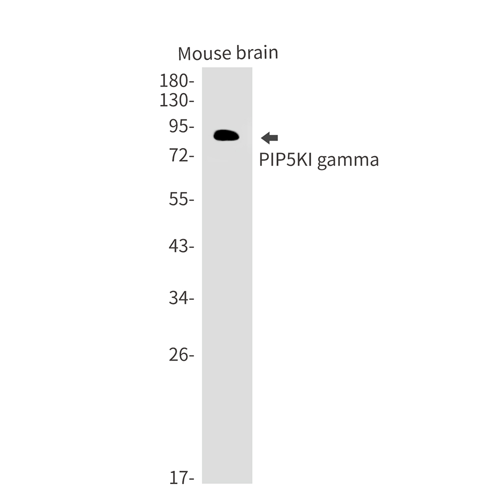 PIP5K1C Rabbit mAb ABZ3118