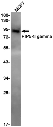 PIP5K1C Rabbit mAb ABZ3118