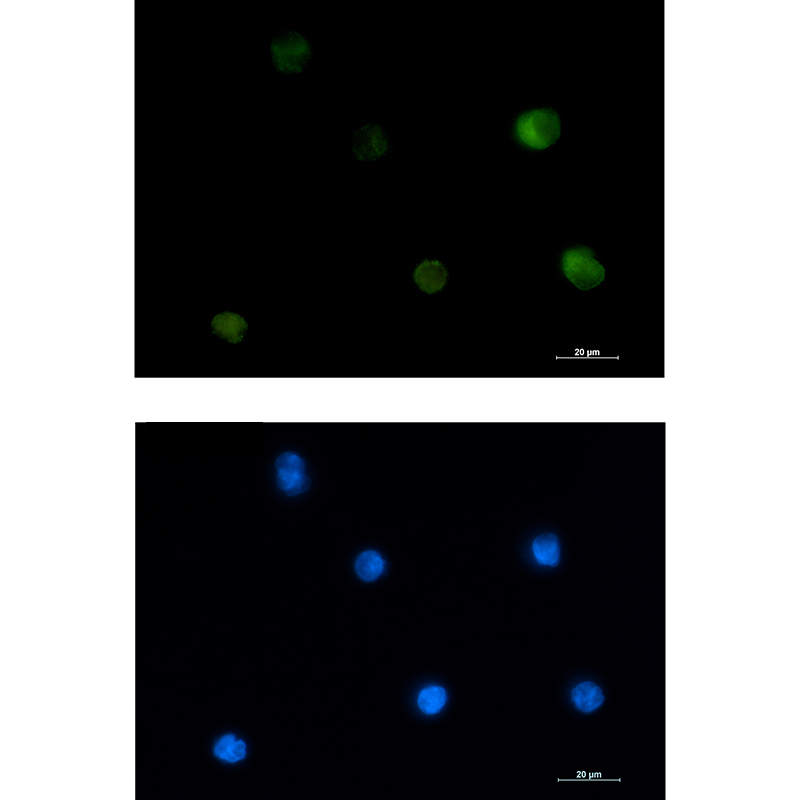 PKC beta 2 Rabbit mAb ABZ3119