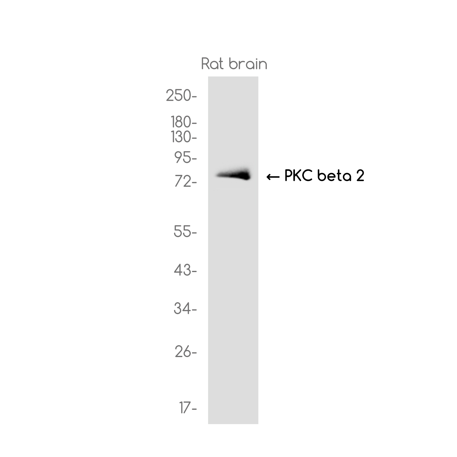 PKC beta 2 Rabbit mAb ABZ3119