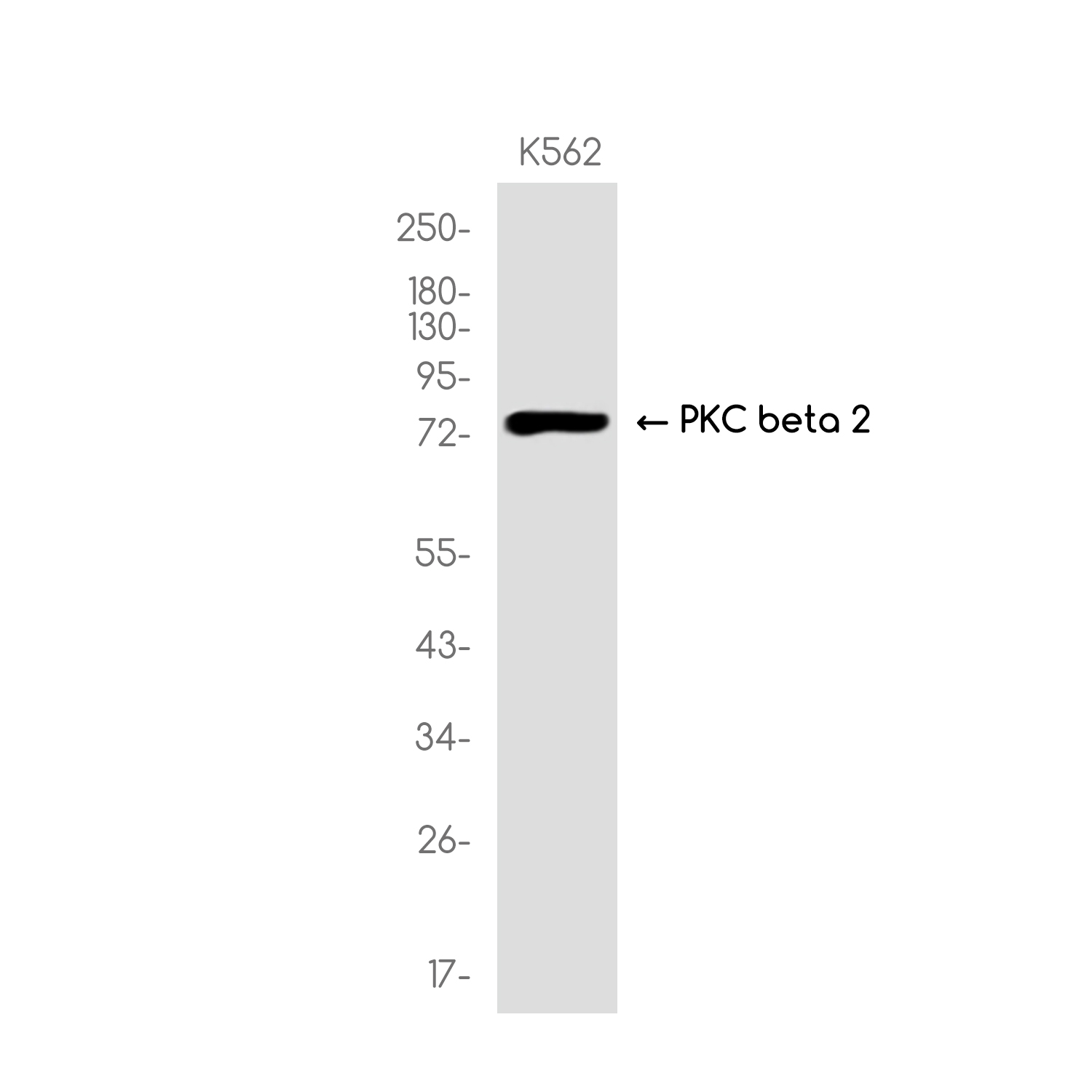 PKC beta 2 Rabbit mAb ABZ3119