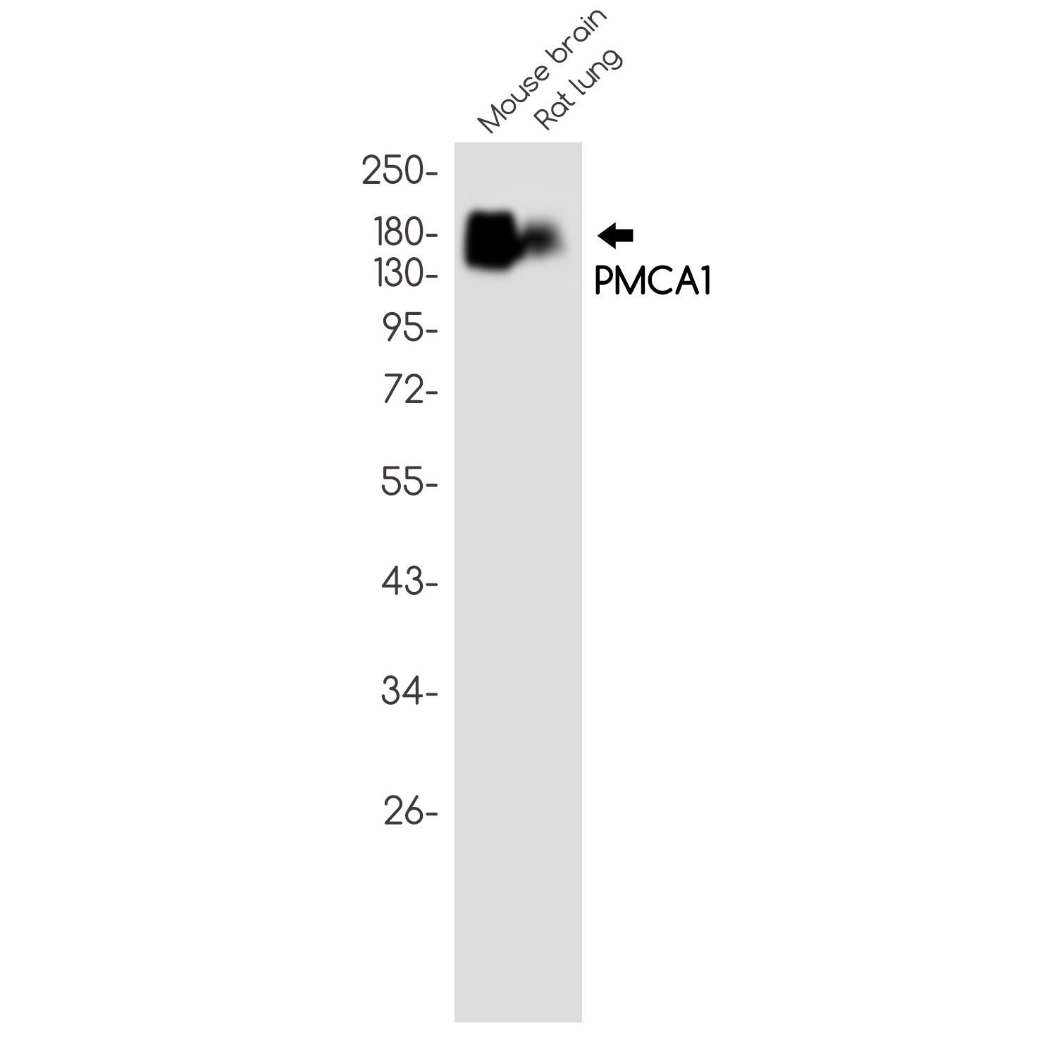 PMCA1 Rabbit mAb ABZ3122