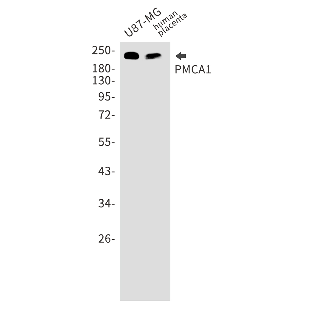 PMCA1 Rabbit mAb ABZ3122