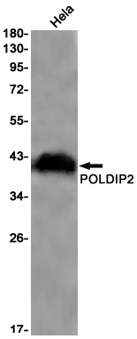 POLDIP2 Rabbit mAb ABZ3123