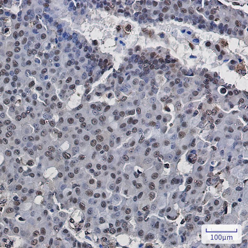 POLR2E/rpb5 Rabbit mAb ABZ3124