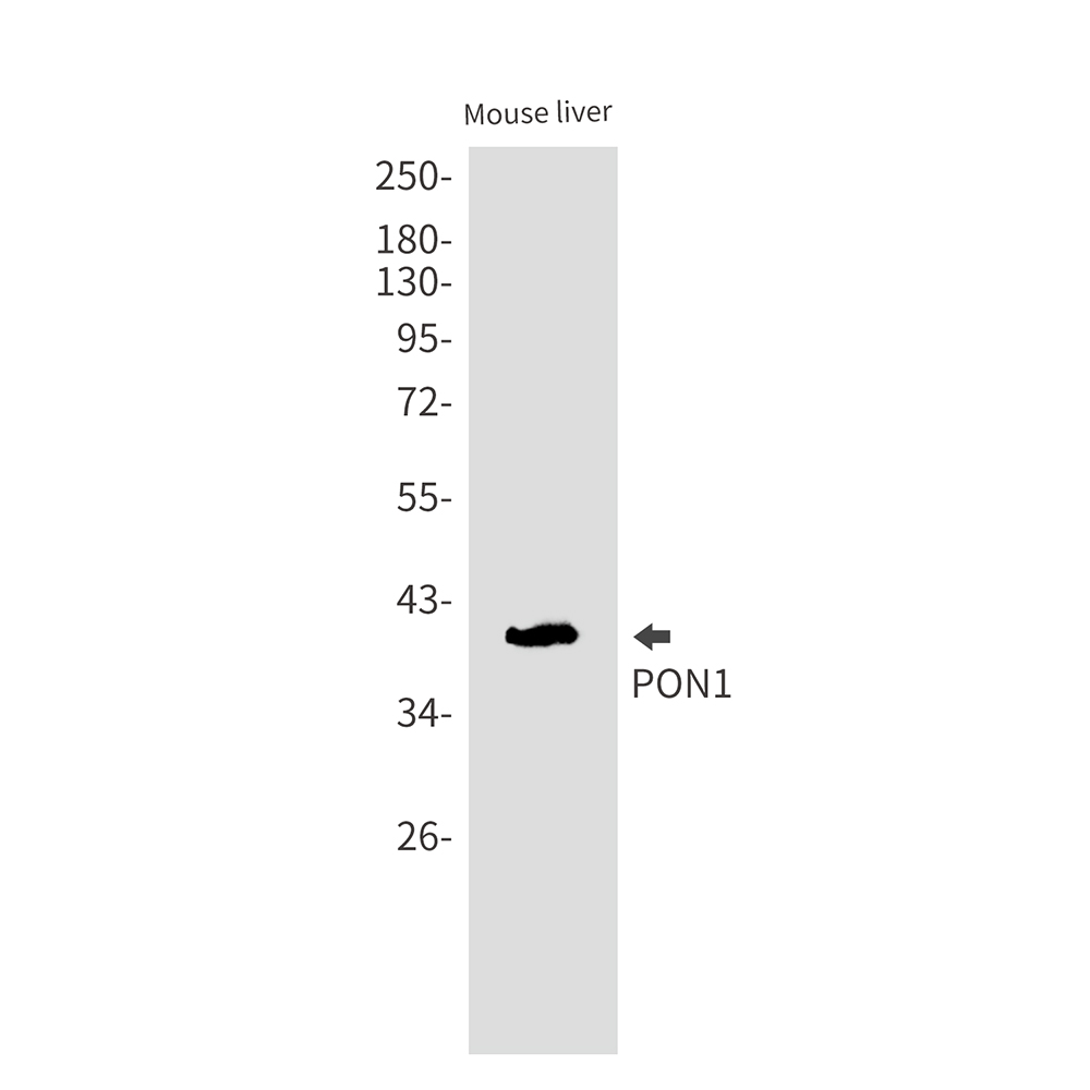 PON1 Rabbit mAb ABZ3125