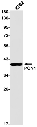 PON1 Rabbit mAb ABZ3125