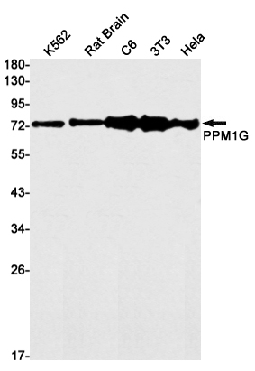 PPM1G Rabbit mAb ABZ3126