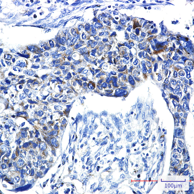 PRC1 Rabbit mAb ABZ3127