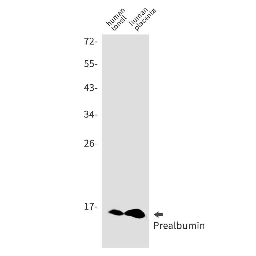 Prealbumin Rabbit mAb ABZ3128