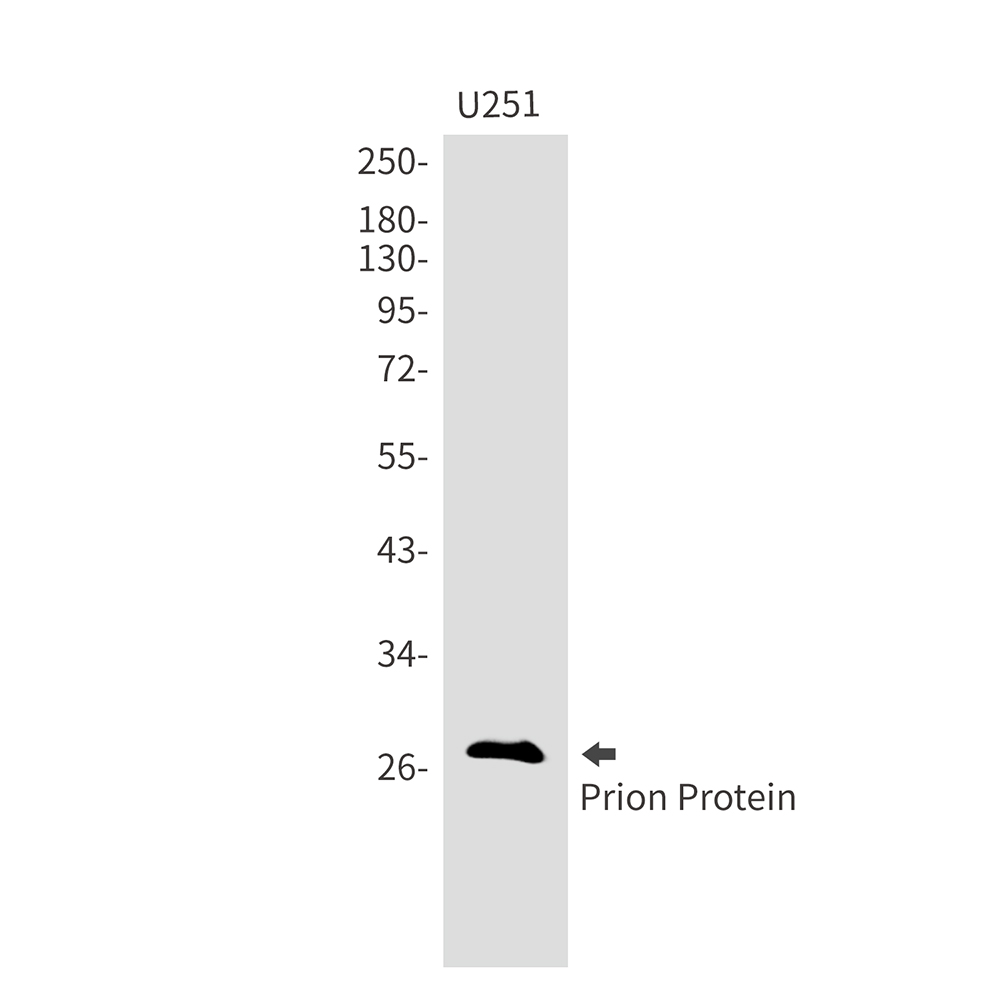 Prion Protein PrP Rabbit mAb ABZ3129
