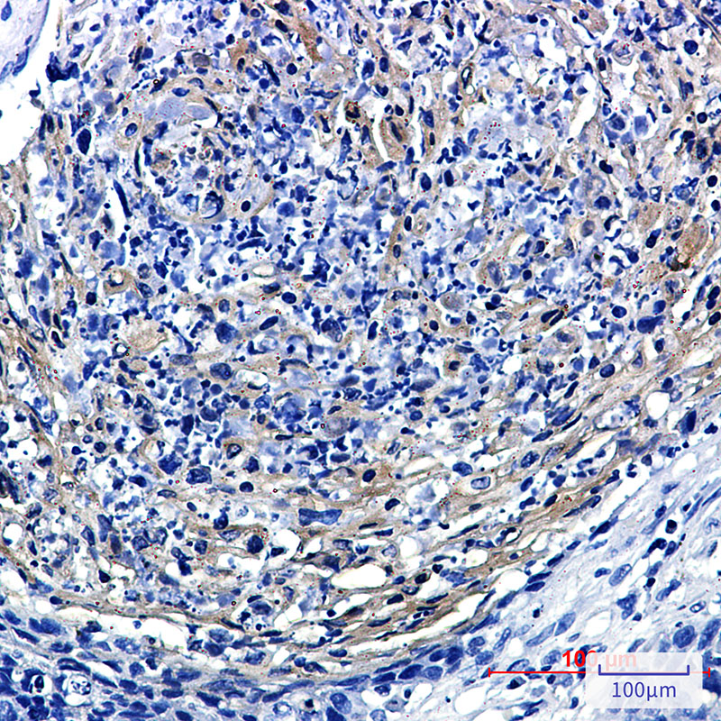PRMT3 Rabbit mAb ABZ3131