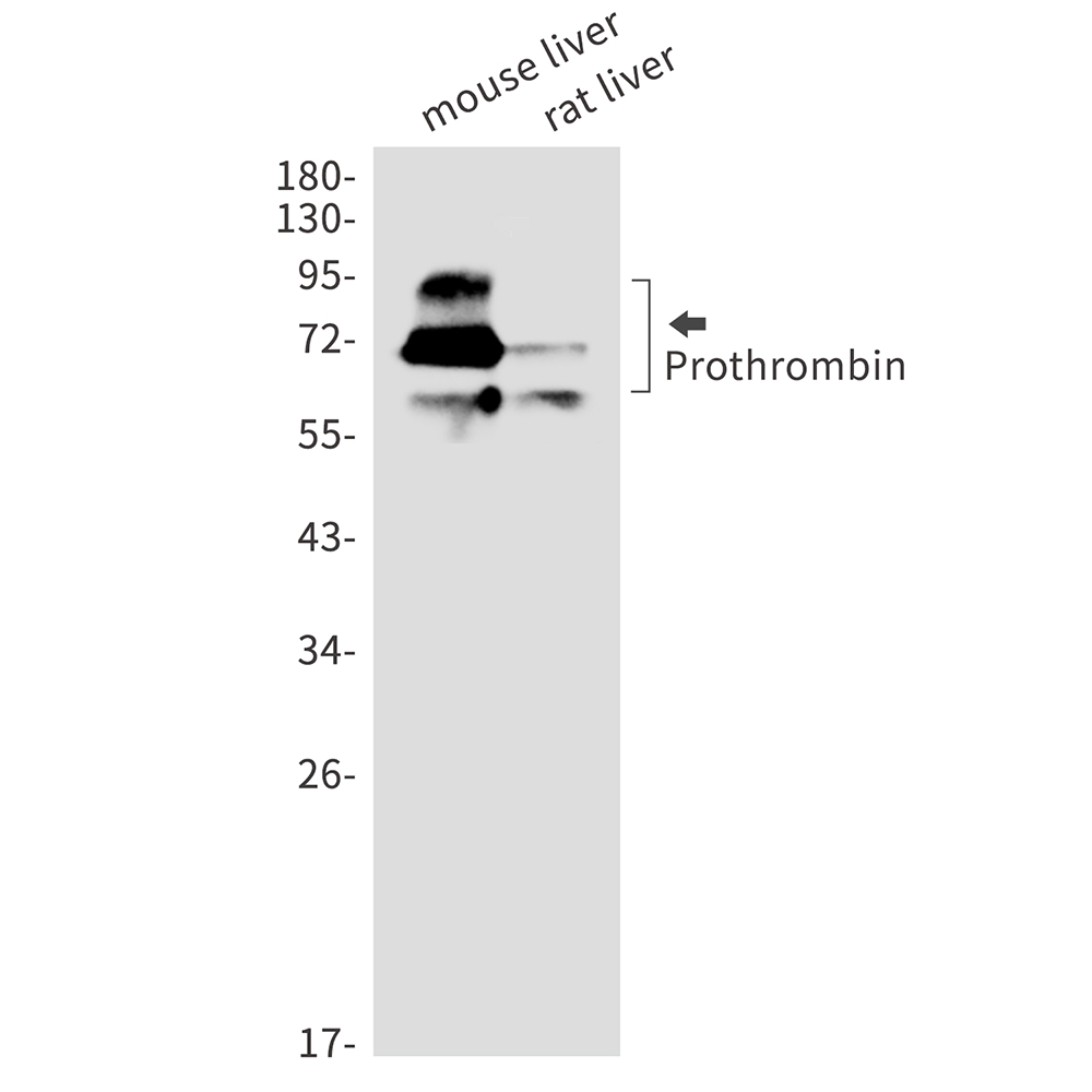 Prothrombin Rabbit mAb ABZ3134