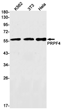 PRPF4 Rabbit mAb ABZ3135